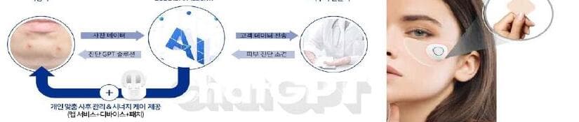 루토닉스 제품 이미지