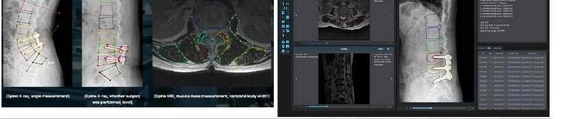 스피나이 제품 이미지