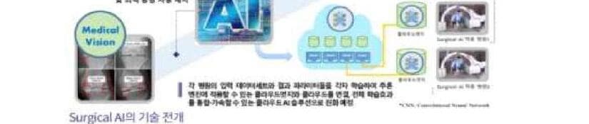 써지컬에이아이 제품 이미지