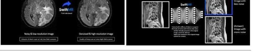 에어스메디컬 제품 이미지
