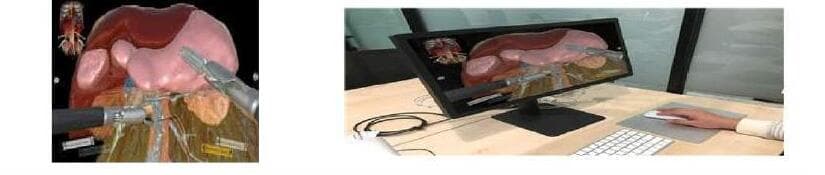 휴톰 제품 이미지