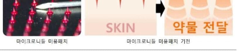 주빅 제품 이미지