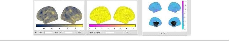 뉴로엑스티 제품 이미지