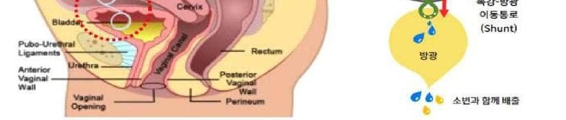 웨이브트리 제품 이미지