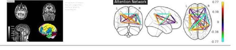 피노맥스 제품 이미지