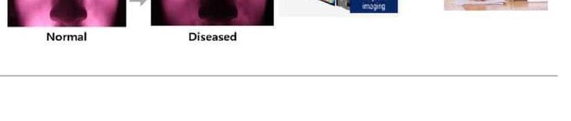 유투메드텍 제품 이미지