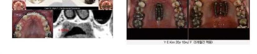 엠케이메디텍 제품 이미지