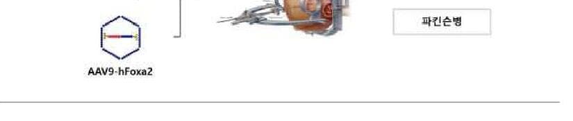 이노퓨틱스 제품 이미지