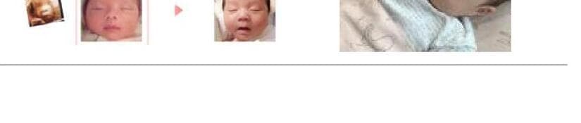 알레시오 제품 이미지