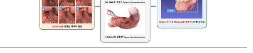 메디인테크 제품 이미지