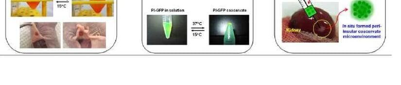 엑셀라몰 제품 이미지