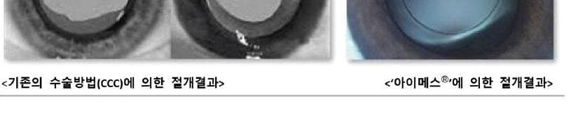 티아이 제품 이미지