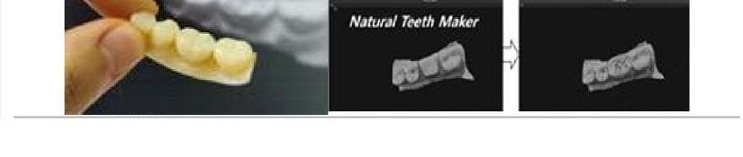 빛날덴탈스튜디오 제품 이미지