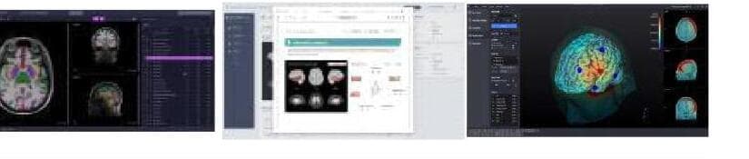 뉴로핏 제품 이미지