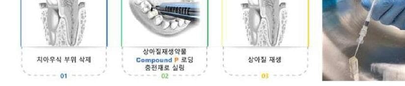 스템덴 제품 이미지