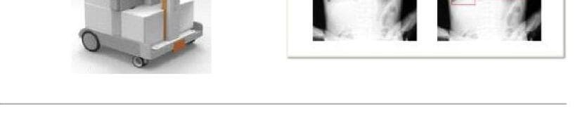 래디센 제품 이미지