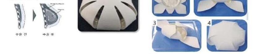 플코스킨 제품 이미지