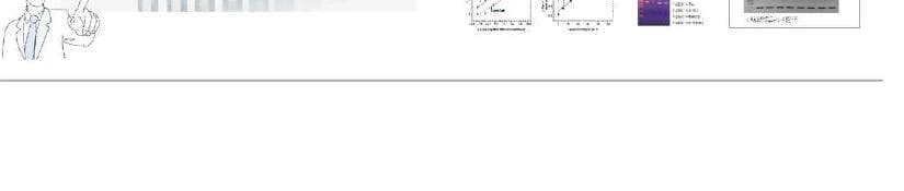 에피젠 제품 이미지