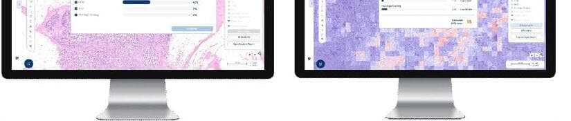 에이비스 제품 이미지