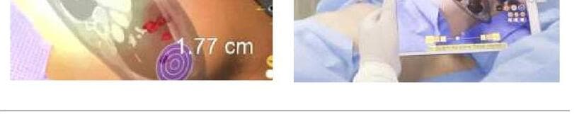 스키아 제품 이미지