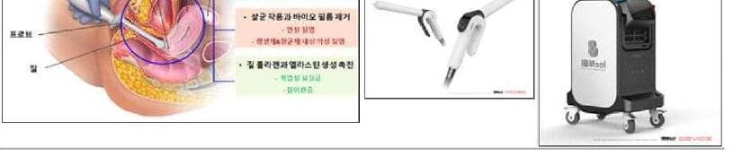 아이비엠솔 제품 이미지