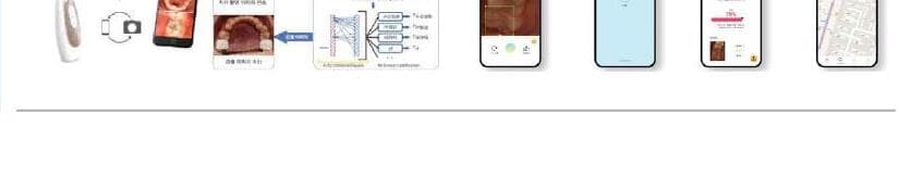 아이클로 제품 이미지