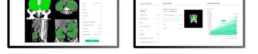 시너지에이아이 제품 이미지