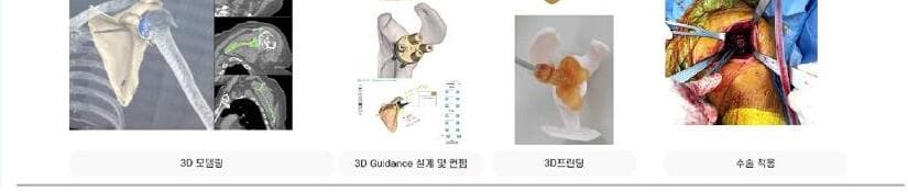 시안솔루션 제품 이미지